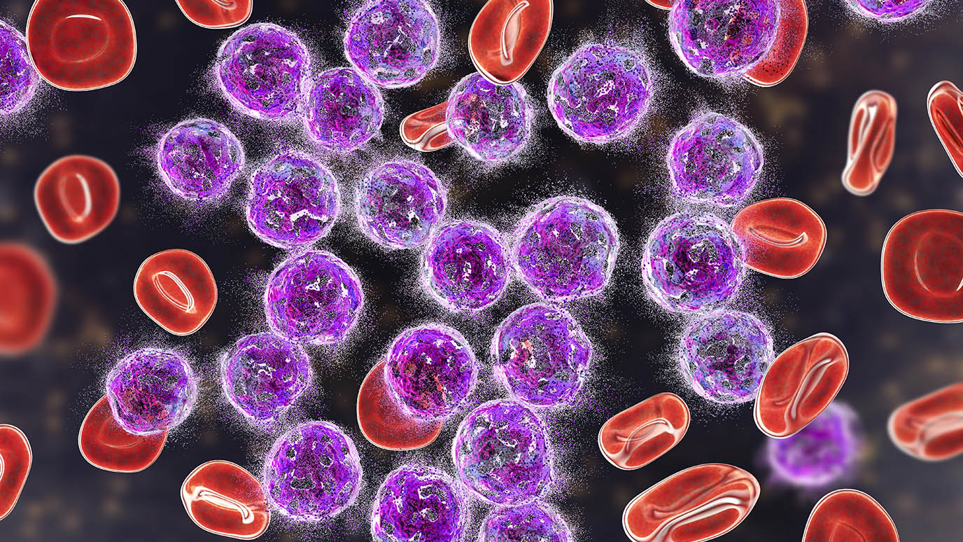 MD Anderson Research Highlights ASH 2021 Special Edition MD Anderson