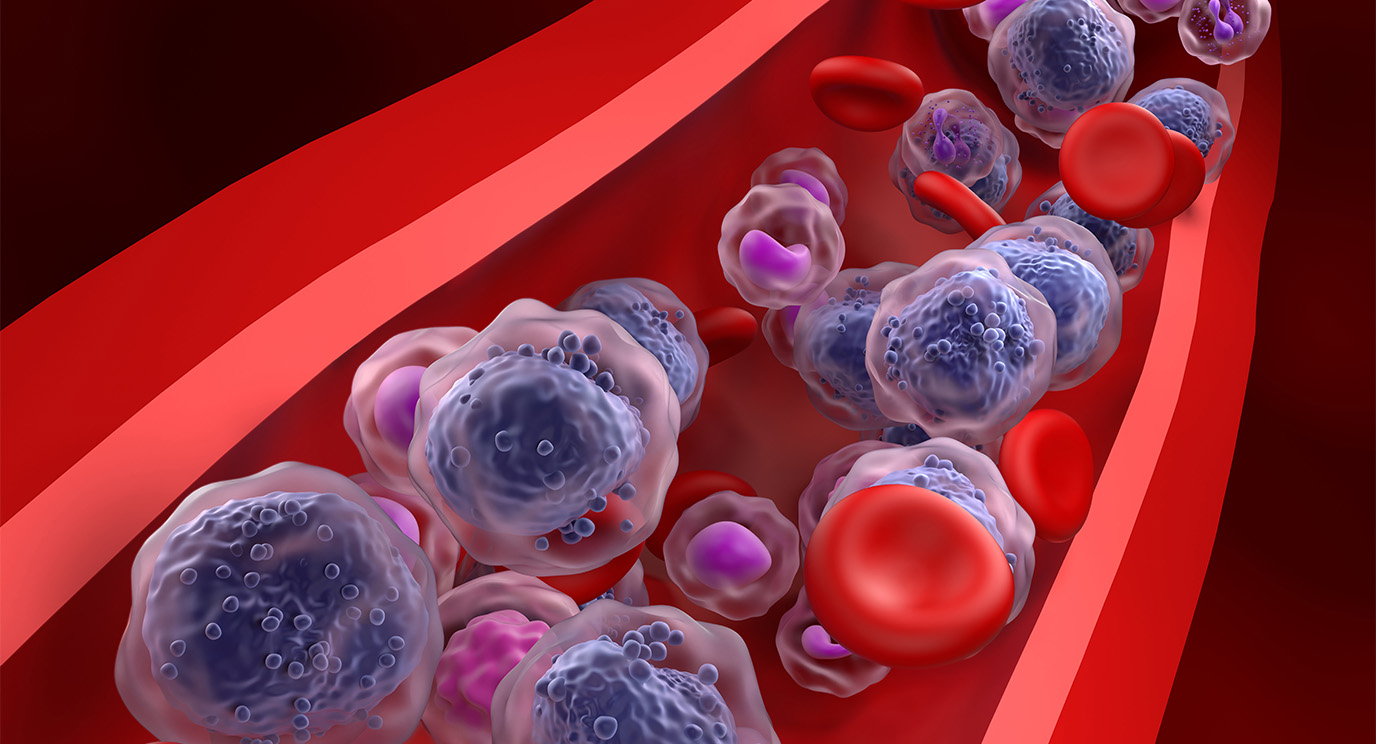 MD Anderson and Rigel collaborate to advance olutasidenib in AML MD