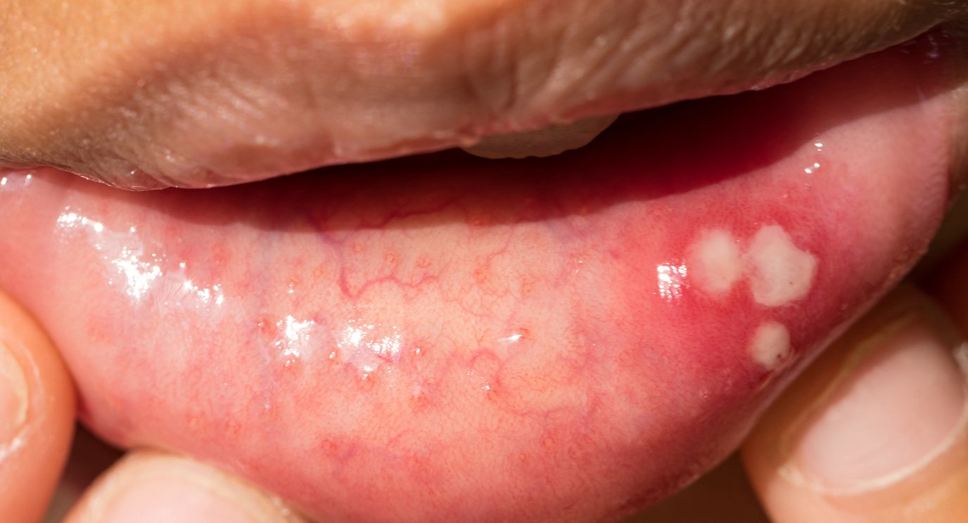 What Are Those Black Spots on Your Vag Lips?