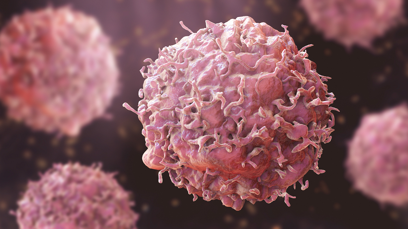 What is the role of ferroptosis in cancer? | UT MD Anderson