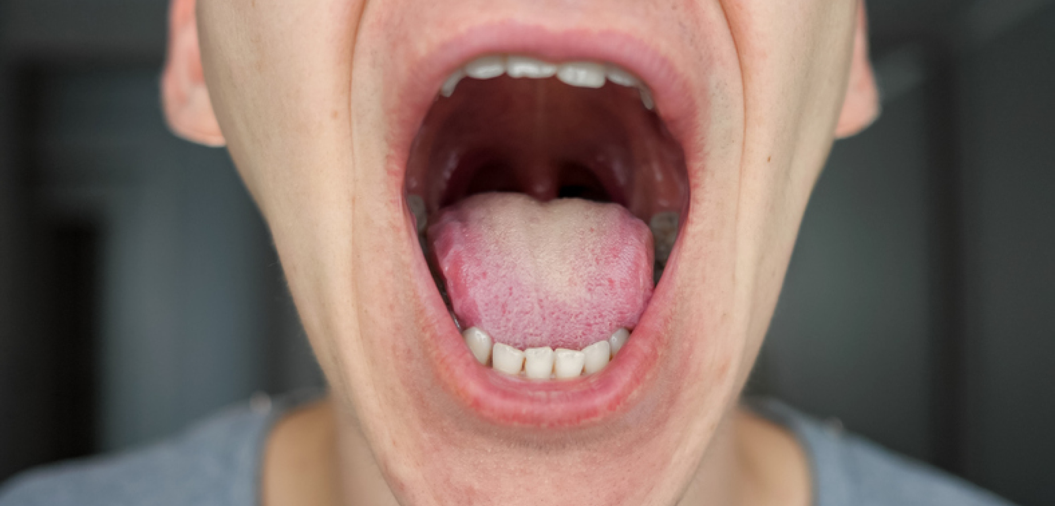 what does a healthy tongue look like