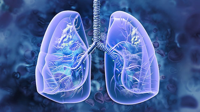 Roche pill divarasib beats two approved drugs in KRAS lung cancer trial