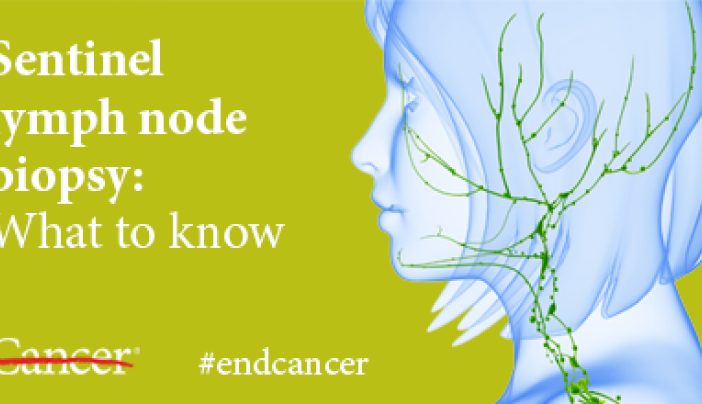 Sentinel Lymph Node Biopsy What Cancer Patients Should Know Md Anderson Cancer Center